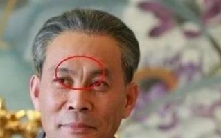 如何应对唐印根断？（解决唐印根断的有效方法和技巧）