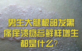 苔藓发黑的原因及处理方法（了解苔藓为什么会变黑以及如何解决）